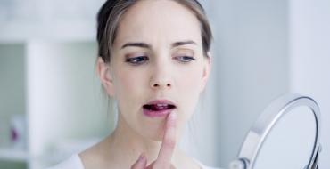 Почему сохнут и трескаются губы у женщин и при беременности